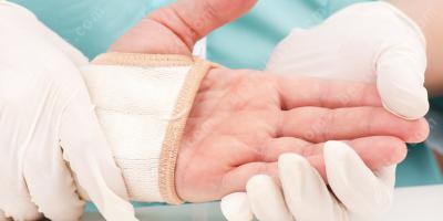 verpletterde hand films