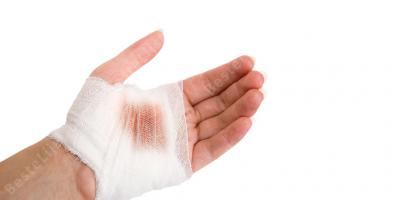 handblessure films