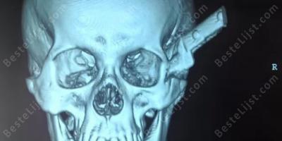 mes in het hoofd films