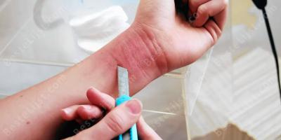 zelfverwonding films