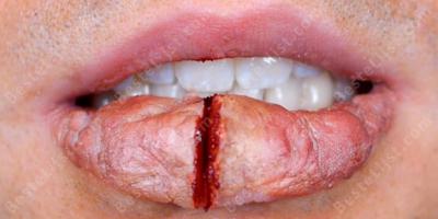 gespleten lip films